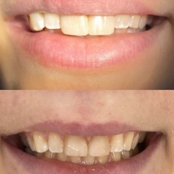 Фото с портфолио DentalProf