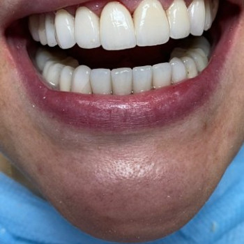 Фото с портфолио DentalProf