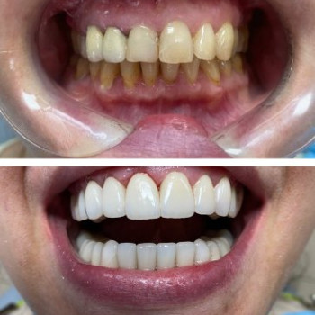 Фото с портфолио DentalProf