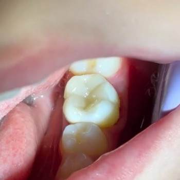 Фото с портфолио DentalProf