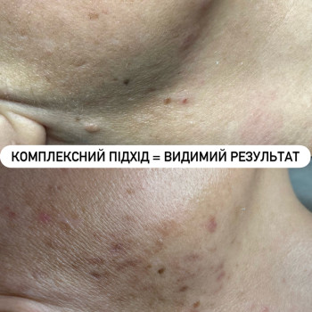 Фото с портфолио Анастасія Дехтярчук