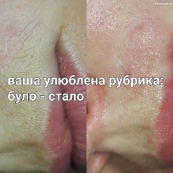 Фото с портфолио Ірина Бережна