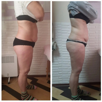 Фото с портфолио Майстерня краси та здоров'я SLIM