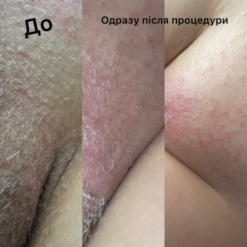 Фото с портфолио Тетяна 