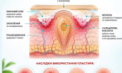 Робота з бородавками 5шт і більше Подолог Ольга Дніпро