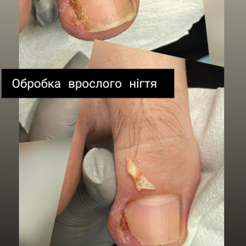 Фото с портфолио Олена Сер'янюк