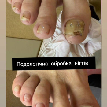 Фото с портфолио Олена Сер'янюк