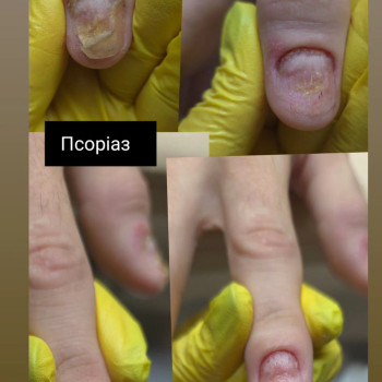 Фото с портфолио Олена Сер'янюк