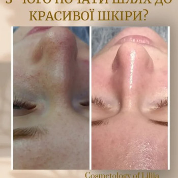 Фото с портфолио Лілія Тишкун