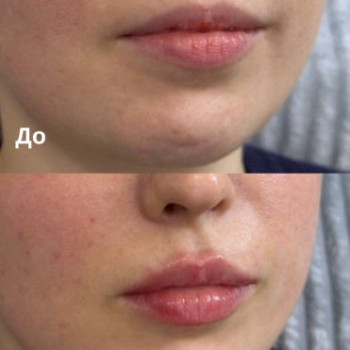 Фото с портфолио TK Laser