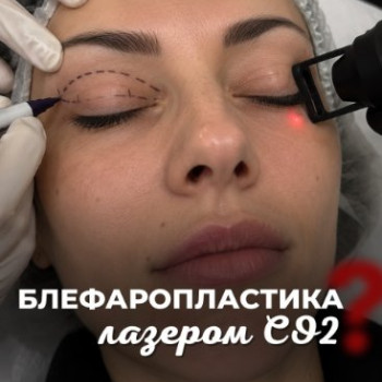 Фото с портфолио Лазерхауз