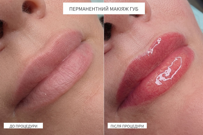 Перманентний макіяж губ: до і після процедури., фото - Косметолог Наталия Филь