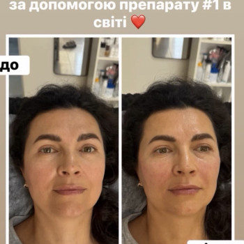 Фото с портфолио Центр лазерної косметології