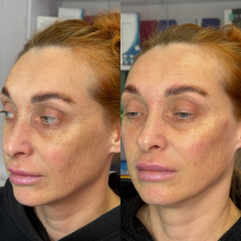 Фото с портфолио Анастасия Миняйленко
