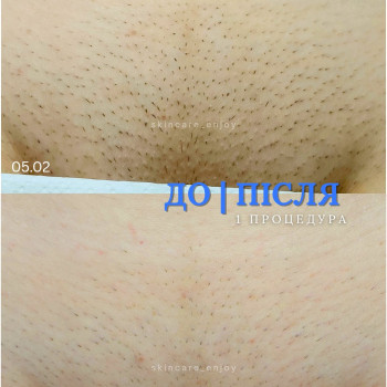 Фото с портфолио Альона Напханько