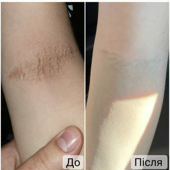 Фото с портфолио Анна Филоненко