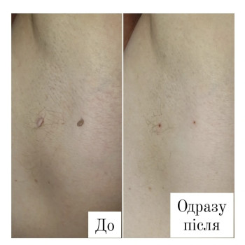Фото с портфолио Анна Филоненко