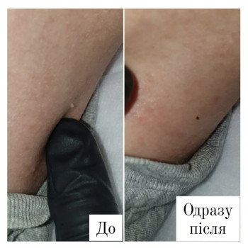 Фото с портфолио Анна Филоненко