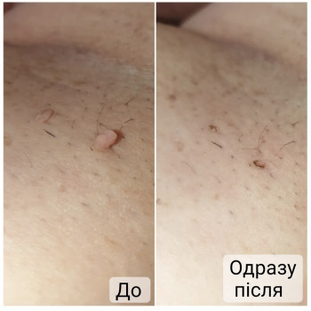 Фото с портфолио Анна Филоненко