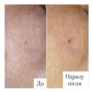 Фото с портфолио Анна Филоненко