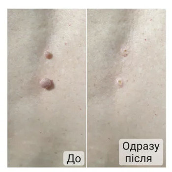Фото с портфолио Анна Филоненко
