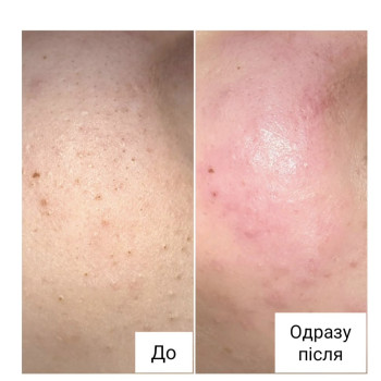 Фото с портфолио Ганна Філоненко