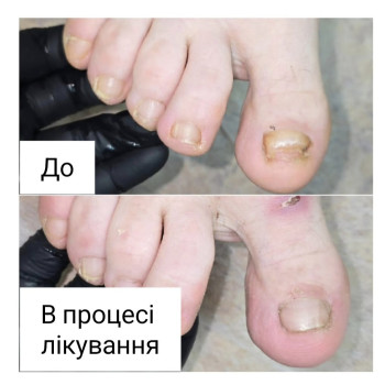 Фото с портфолио Анна Филоненко