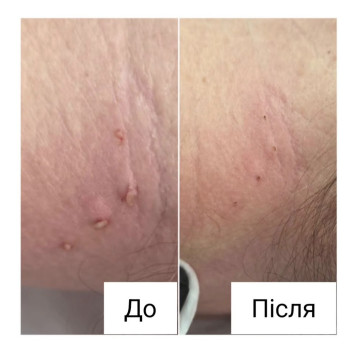 Фото с портфолио Анна Филоненко