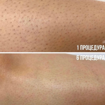 Фото с портфолио Фантазія