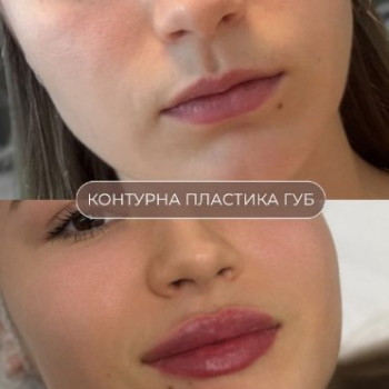 Фото с портфолио Laser Life
