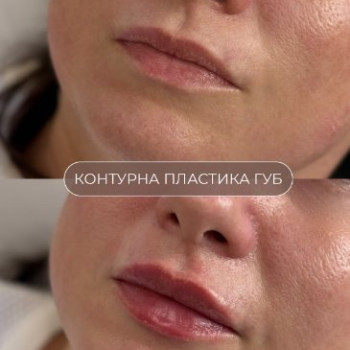 Фото с портфолио Laser Life