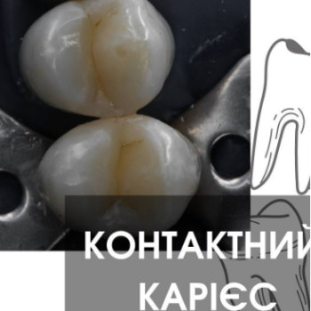 Фото с портфолио Orit