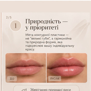 Фото с портфолио Екатерина Стельмашенко