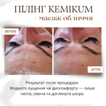 Фото с портфолио Наталія Верещакіна