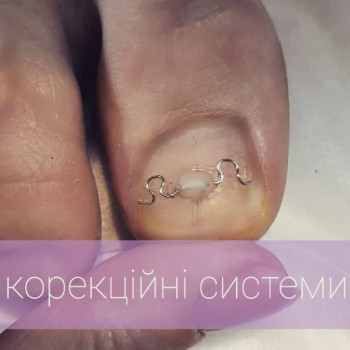 Фото с портфолио Олена Боїла
