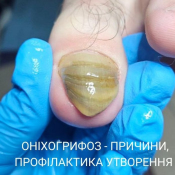 Фото с портфолио Вікторія Москальчук
