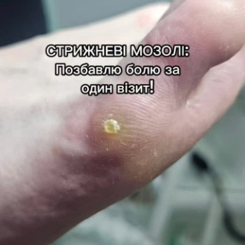 Фото с портфолио Вікторія Москальчук