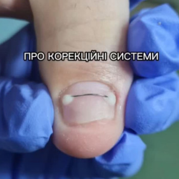 Фото с портфолио Вікторія Москальчук