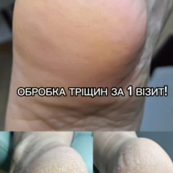 Фото с портфолио Вікторія Москальчук