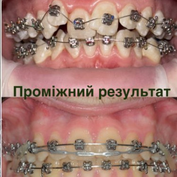 Фото с портфолио Анжела Безпалько