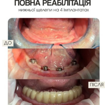 Фото с портфолио Ольга Харчук