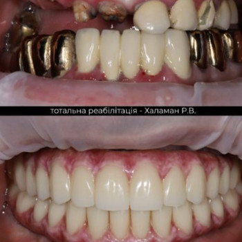 Фото с портфолио Ростислав Халаман