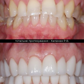 Фото с портфолио Ростислав Халаман