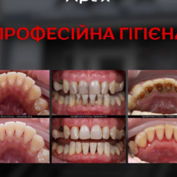 Фото с портфолио Ростислав Халаман