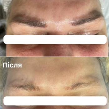 Фото с портфолио TK Laser