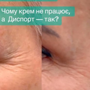 Фото с портфолио СПАБЕЛЬ