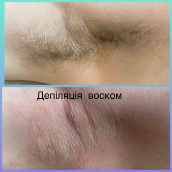 Депіляція воском