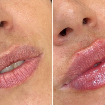 Фото с портфолио Светлана Лищук