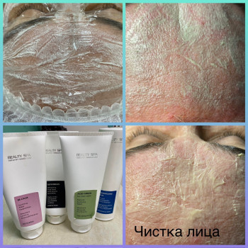 Механічна чистка обличчя