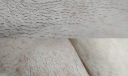 Электро эпиляция Мастер депиляции Виктория Харьков